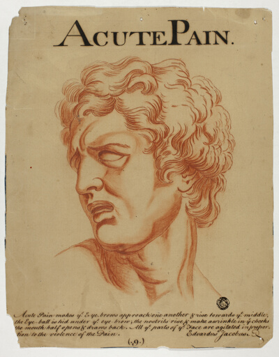 Acute Pain