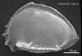 Brachycythere sp.