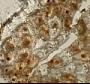 Bryopesanser sp.