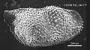 Bythoceratina sp