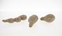 Calcareous concretion