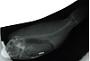 Callyodon oedema Snyder