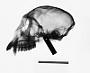 Cercopithecus mitis stuhlmanni