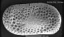 Cytherella sp.