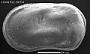 Cytherella sp.