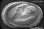 Cytherelloidea sp