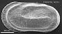 Cytherelloidea sp