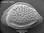 Cytheropteron sp.