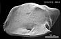 Cytheropteron sp.