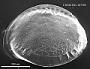 Cytheropteron sp.