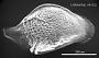 Cytheropteron sp.