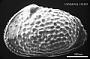 Echinocythereis sp
