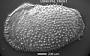 Echinocythereis sp