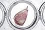 Gastropoda