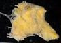 Halichondria sp.
