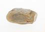 Phosphate concretion