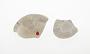 Phosphatic concretion