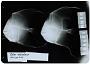 Platax orbicularis
