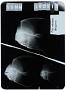 Platax orbicularis