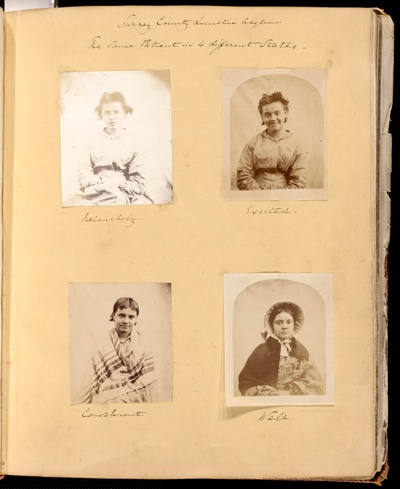 Surrey County Lunatic Asylum, The Same Patient in 4 Different States: Melancholy, Excited, Convalescent, Well Untitled, 1849–60, from the George Cowper Album, assembled 1849–60